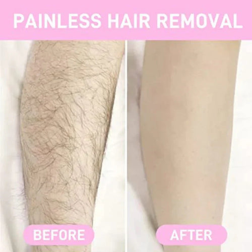 2 in 1 Rechargeable YES Finishing Touch Facial And Body Hair Remover (Imported)