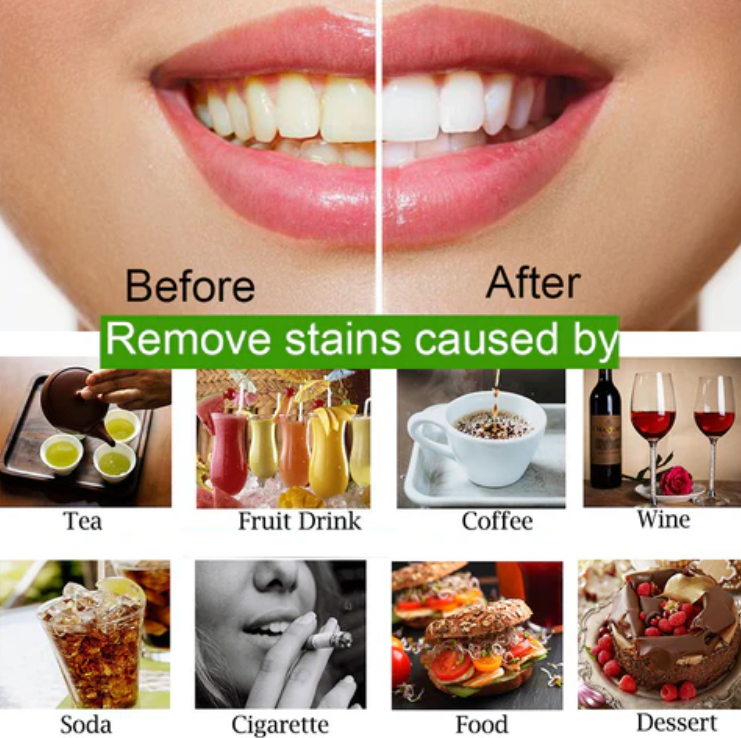 Mad Smile Teeth Cleaning Powder (organic) White (30g)